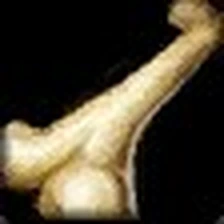 Stonevault Bonebreaker, official Blizzard item icon